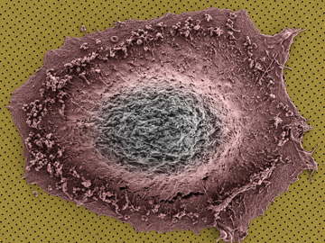 Electron micrograph of cell