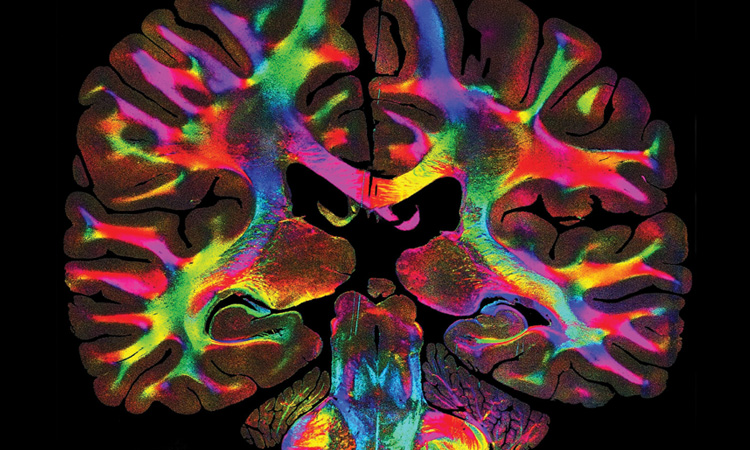 Image of brain fibers