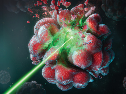 Renewed Momentum for Photodynamic Therapy