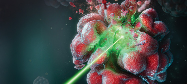 Renewed Momentum for Photodynamic Therapy