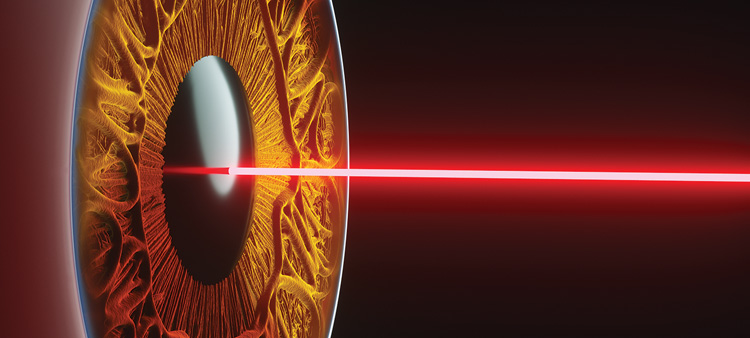 The Enduring Impact of Excimer Lasers