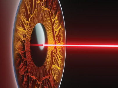 The Enduring Impact of Excimer Lasers