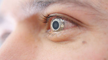 Close up of eye with smart contact lens