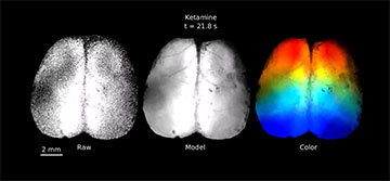 Neural activity in mouse brain