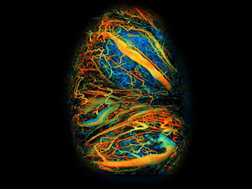 A Photoacoustic View of a Mouse Placenta