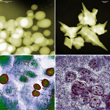 Gold nanoparticles and colon cancer cells