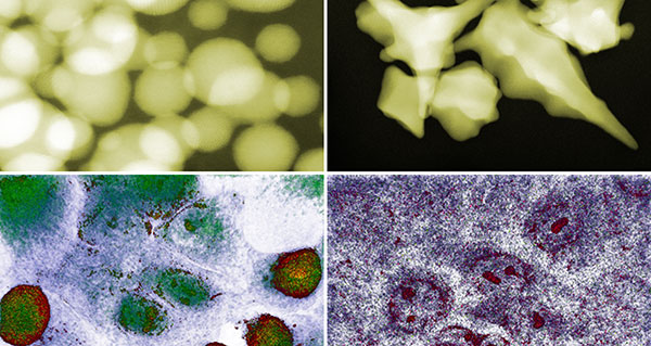 Optics & Photonics News - How Gold Nanoparticles Kill Cancer Cells