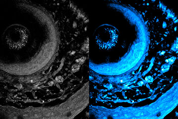 Side by side images of living tissue, one in grey scale and the other in blue