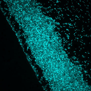 Teal bacteria clustered together