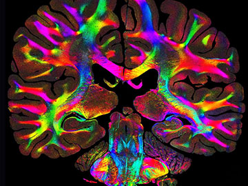 Neural Pathways Come into View