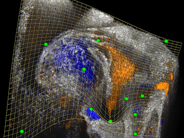 Better 3D and 4D Visualization of Biomedical Images