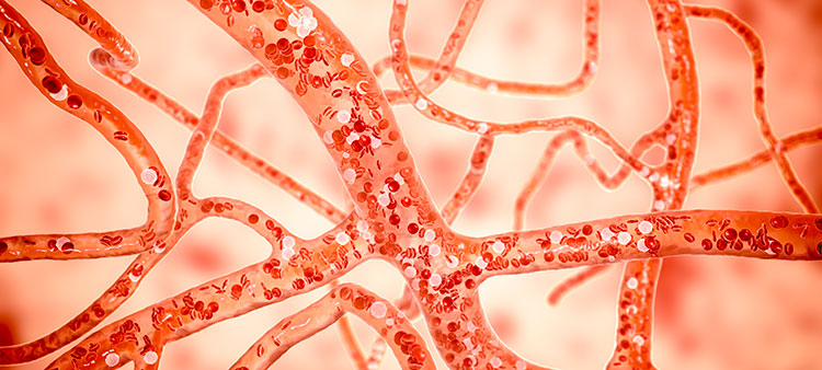 Optoacoustic Scanning for Early Signs of Heart Disease