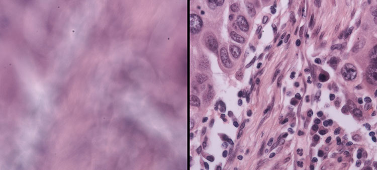 Keeping Microscope Images in Focus