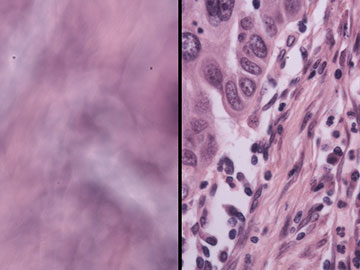 Keeping Microscope Images in Focus