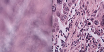 Blurry microscopy image next to focused version