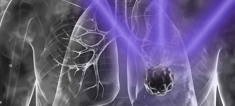 Light Switch “Wakes Up” Sleeping Cancer Cells