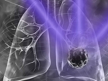 Light Switch “Wakes Up” Sleeping Cancer Cells