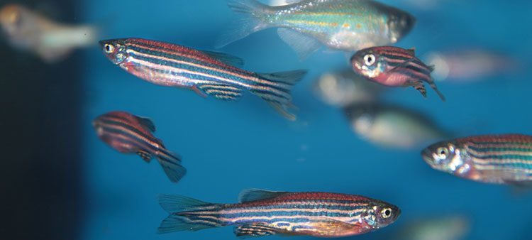 3D Imaging Tracks Seizures in Real Time